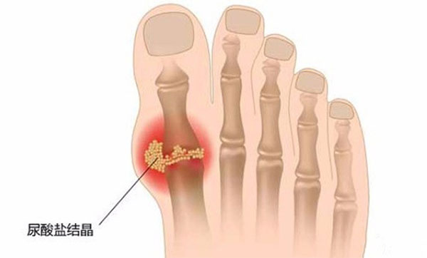 �������ʲô����� �����ҪԶ����Щʳ��